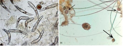 현미경으로 확인된 모낭충(좌)과 옴진드기(우) / 사진제공=24시사람앤동물메디컬센터